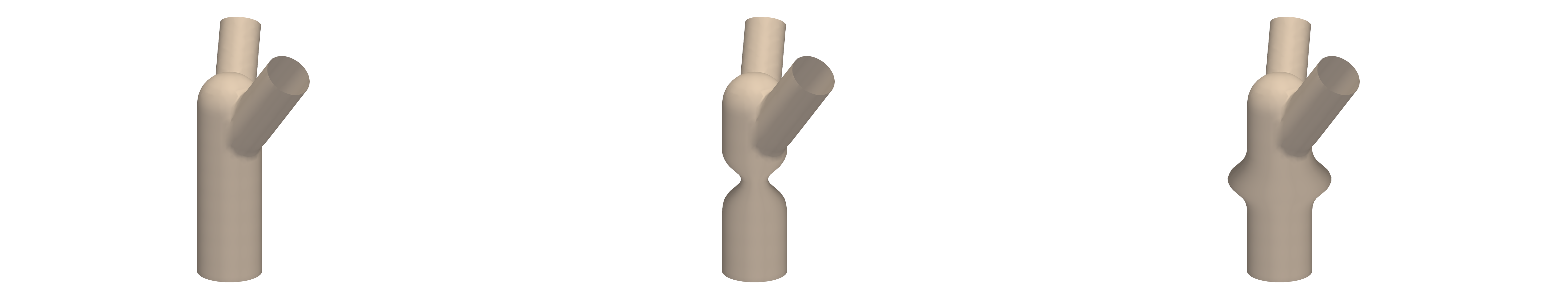Implicit Y-junction with parametric stenosis and dilation variants.
