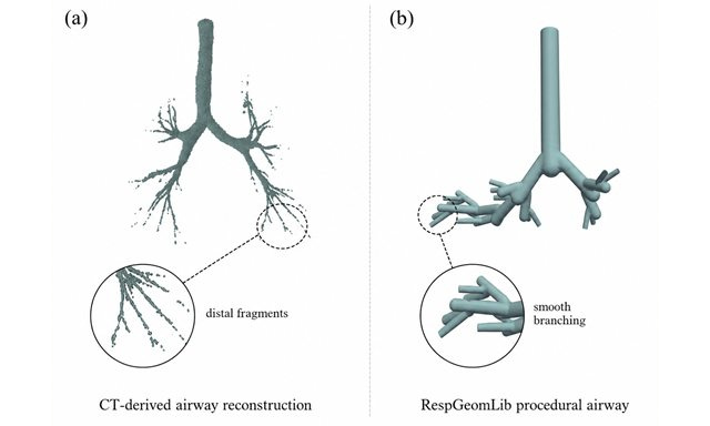 A CT-derived airway reconstruction that breaks into distal fragments, beside a RespGeomLib procedural airway with smooth branching at every junction.