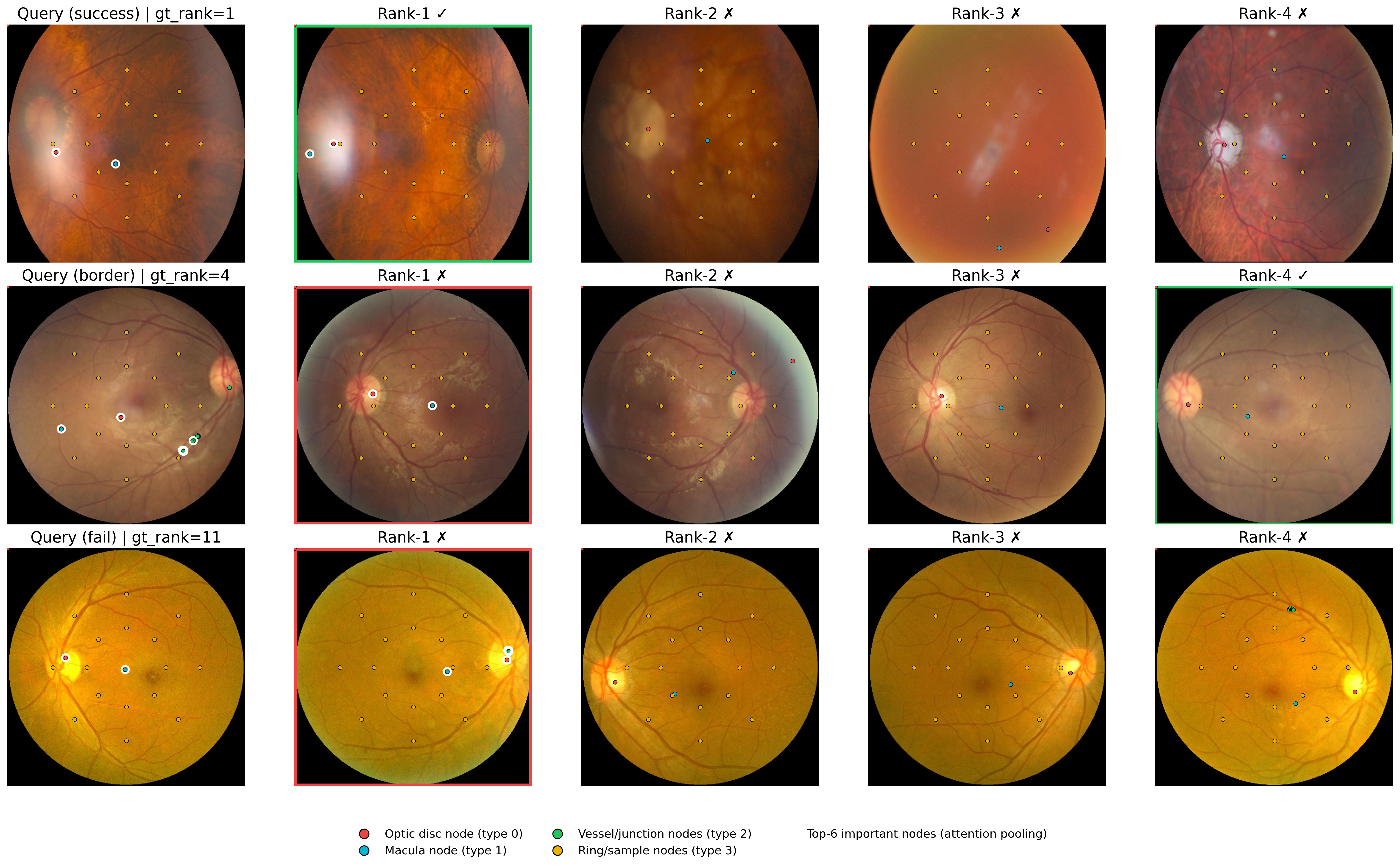 Fundus anatomy-aware retrieval explanations